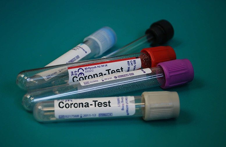 Teströhrchen "Corona-Test" (Aufschrift)